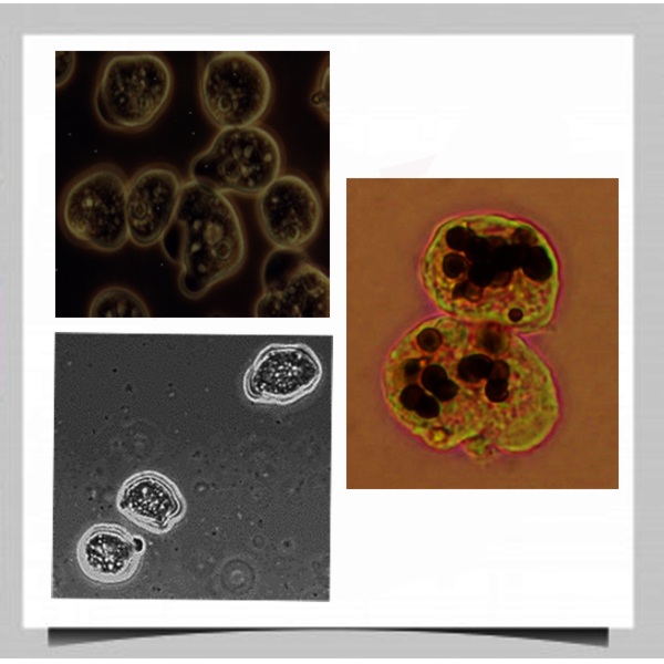 Entamoeba histolytica