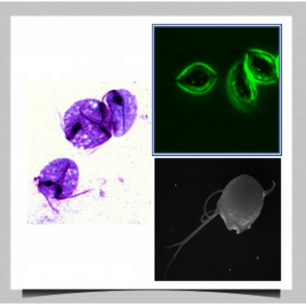 Trichomonas vaginalis