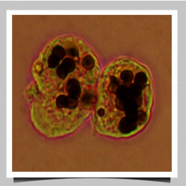 Entamoeba histolytica